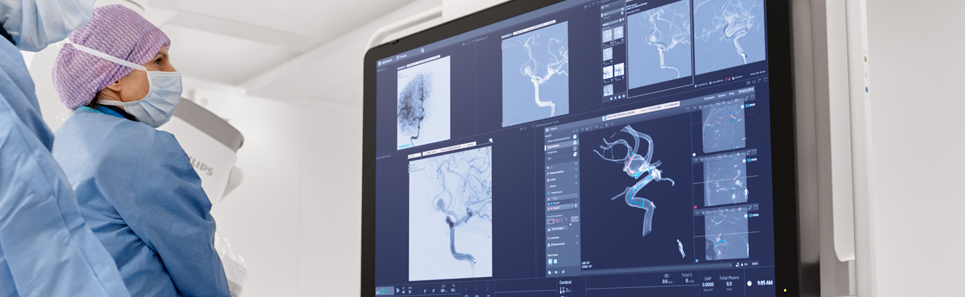 IGT Terapia guiada por imagen - Sala de Neurolog&iacute;a