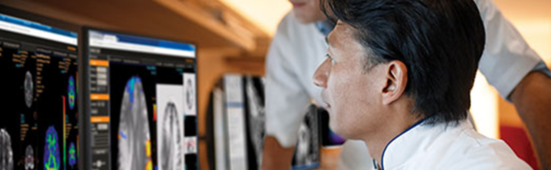 Resonancia Magn&eacute;tica - Estudios de Neuro Perfusi&oacute;n