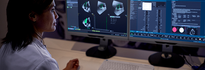 una persona mirando la pantalla de una computadora