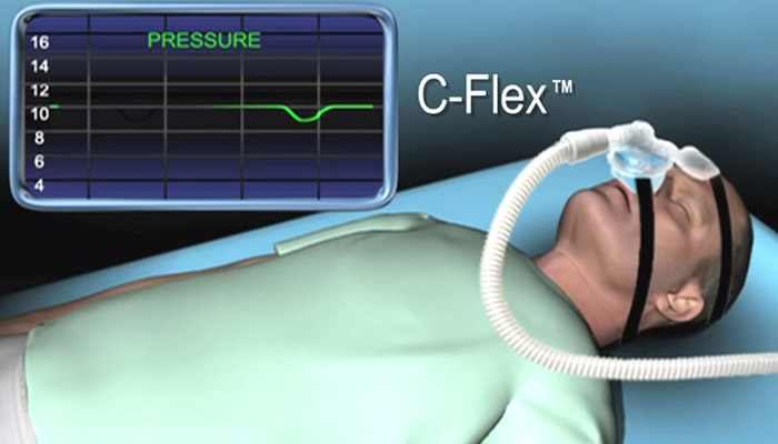 Tratamiento de la Apnea del Sue&ntilde;o