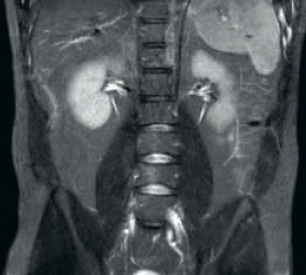 Recepci&oacute;n de dStream