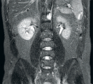 Otra recepci&oacute;n de RF