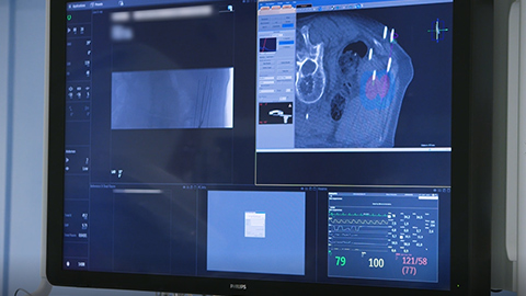 Testimonio de clientes de Philips Azurion 7 C20, St. Antonius Nieuwegein, Pa&iacute;ses Bajos