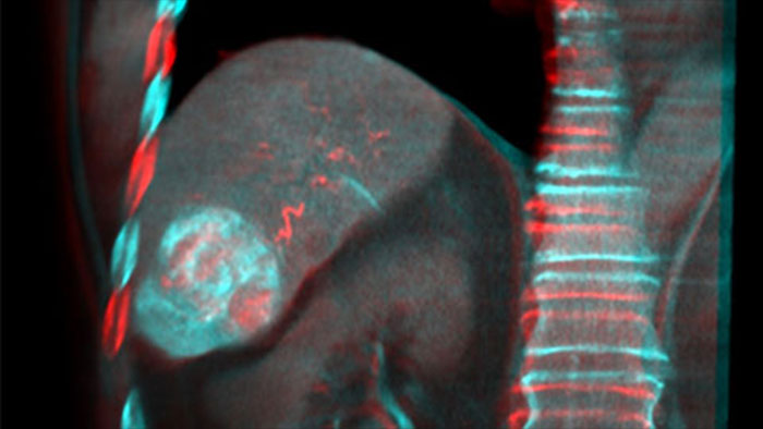 Fusi&oacute;n de im&aacute;genes con Dual View