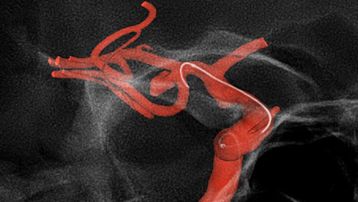 Visualizaci&oacute;n mejorada de SmartCT Roadmap