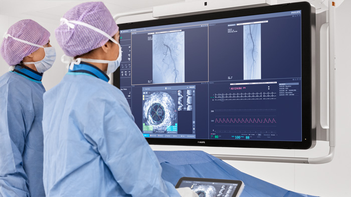 Tratamiento de la MAV