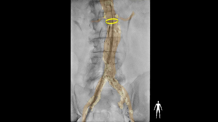 Contacto de la suite Vascular