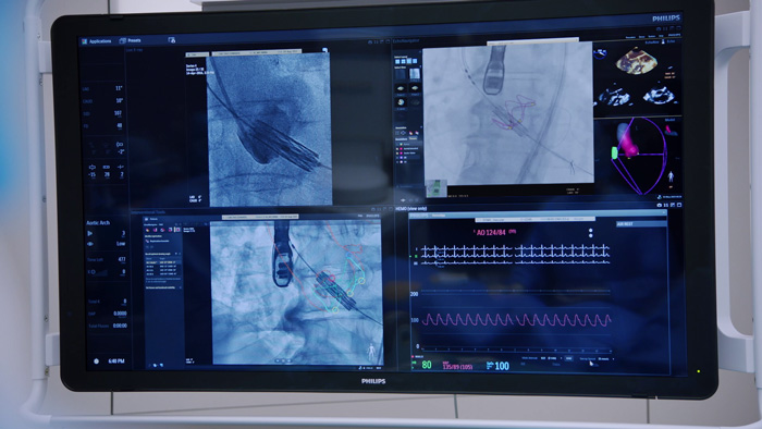 Vascular a&oacute;rtica