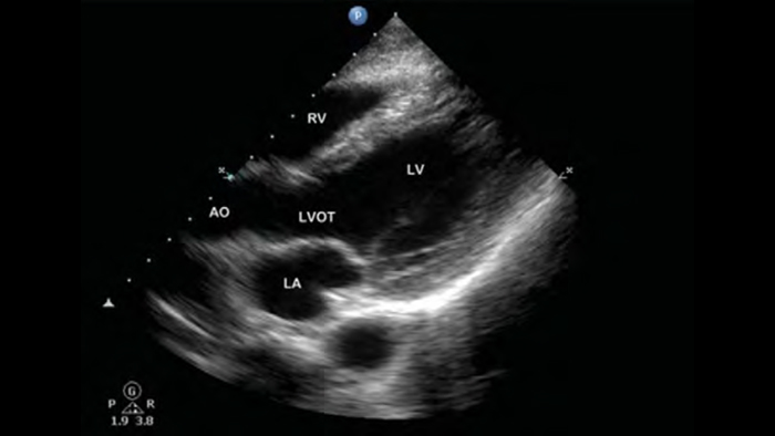 Tel&eacute;fono junto al producto Lumify