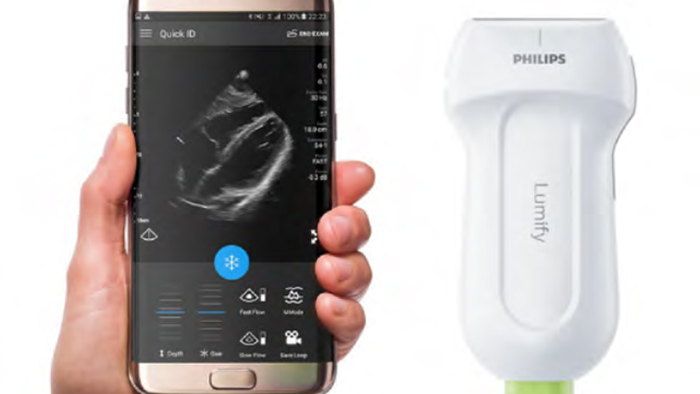 Tel&eacute;fono junto al producto Lumify