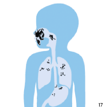 M&aacute;scara con un sello deficiente