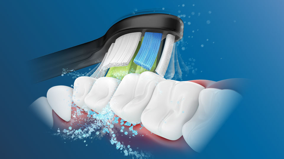 :&iquest;En qu&eacute; consiste la tecnolog&iacute;a s&oacute;nica de Philips Sonicare? 