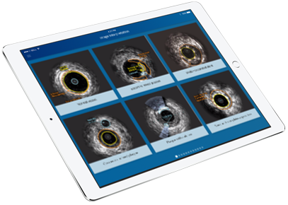 EIV de experto en IPAD