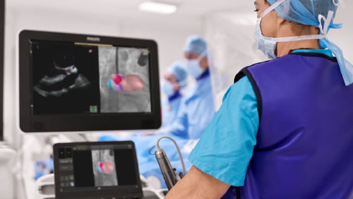 Philips incluye la IA en sus soluciones de salud para ofrecer mejores cuidados a m&aacute;s personas
