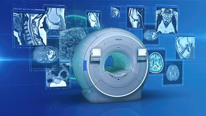Philips HealthTech Spot: Episodio 4 &ndash; Calidad de imagen y velocidad a su alcance con Philips SmartSpeed