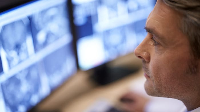Philips HealthTech Spot: Episodio 7 &ndash; Conozca los &uacute;ltimos avances en diagn&oacute;stico por im&aacute;genes