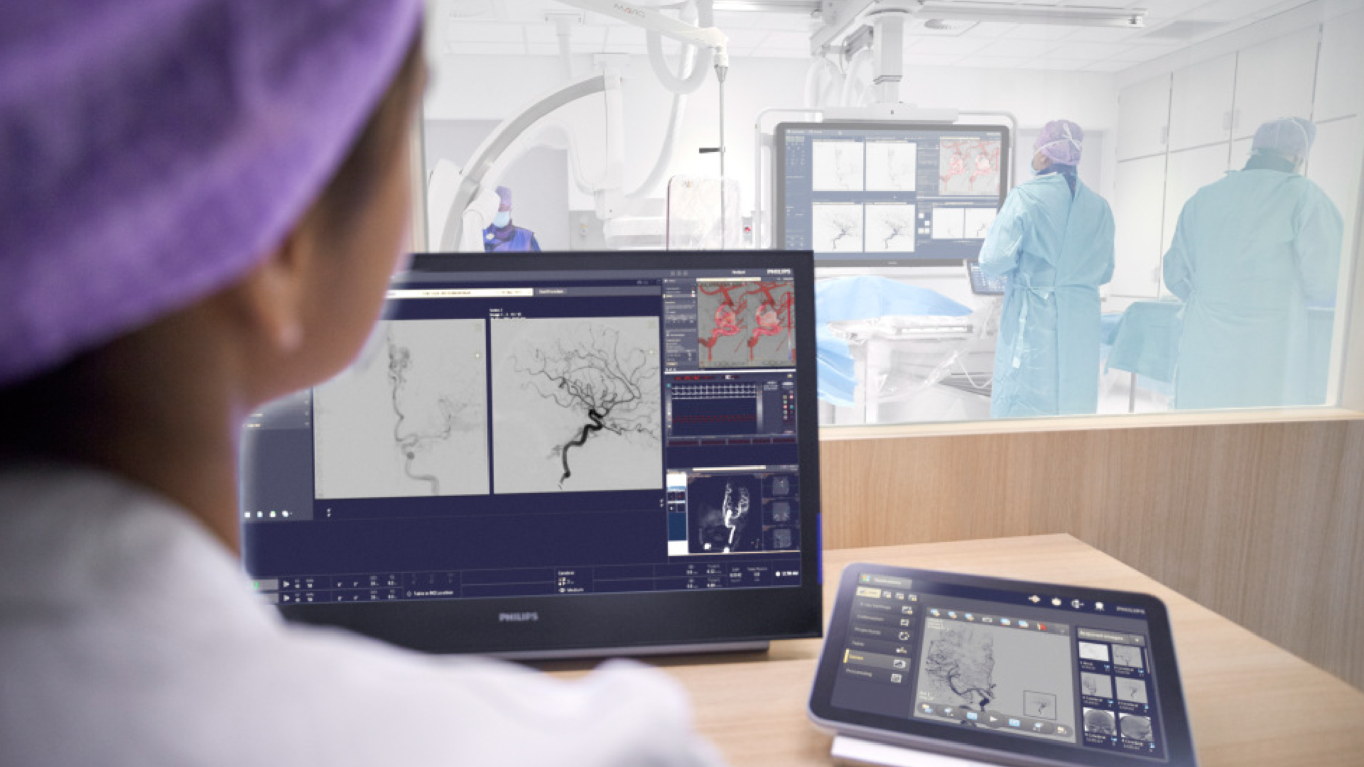 Philips present&oacute; novedosos avances en Neurointervenci&oacute;n en el 3er Congreso Chileno de Enfermedades Cerebrovasculares.