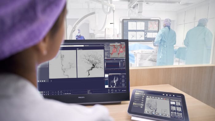 Philips present&oacute; novedosos avances en Neurointervenci&oacute;n en el 3er Congreso Chileno de Enfermedades Cerebrovasculares.