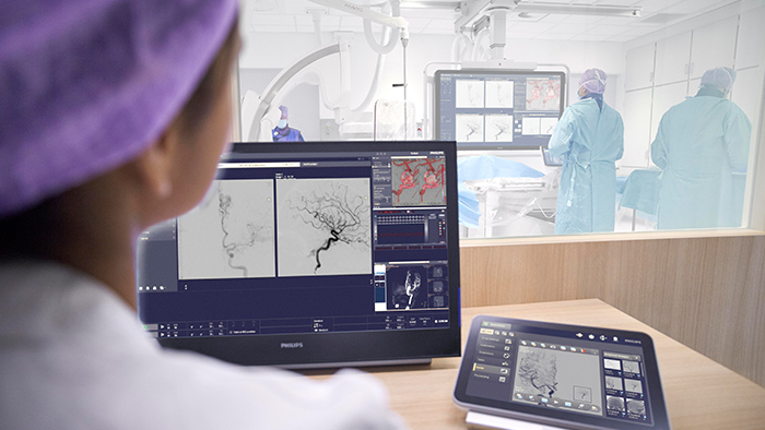 La Organizaci&oacute;n Mundial de Accidentes Cerebrovasculares y Philips hacen un llamamiento para ampliar el acceso a los cuidados que salvan vidas en caso de accidente cerebrovascular